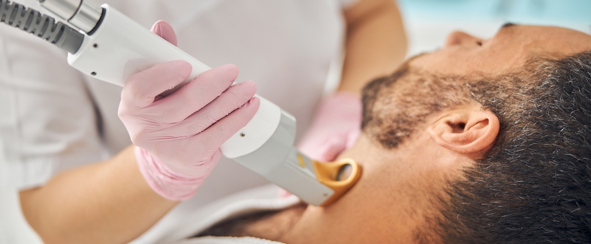 Why More Men Are Choosing Laser Hair Removal (And Why You Should Too!)
