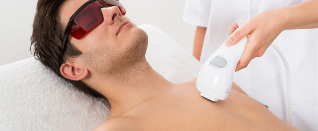 MALE FULL BODY LASER HAIR REMOVAL TREATMENT