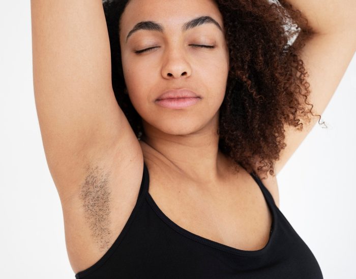 Dark Underarms Laser Hair Removal Solution