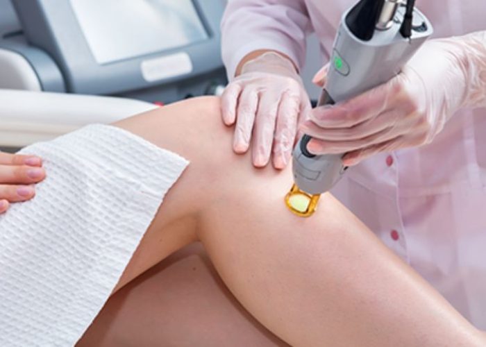 Your Guide to Laser Hair Removal Clinics in Melbourne